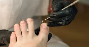 Maestría Cirugía de Mínima Incisión para Podólogos