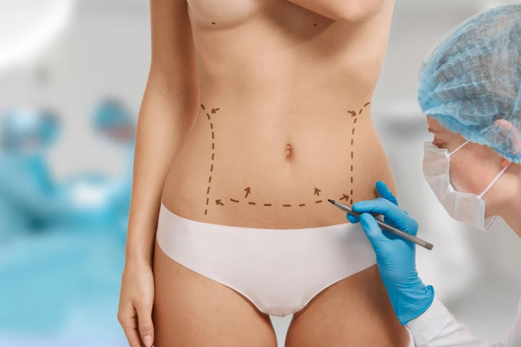 Maestría en Cirugía de Contorno Corporal Liposucción Lipo HD y Lipoescultura 3