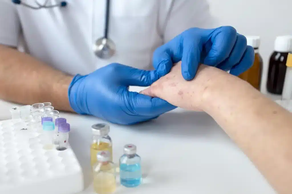 Maestría en Complicaciones Cutáneas por Estética Necrosis Granulomas e Infecciones 1