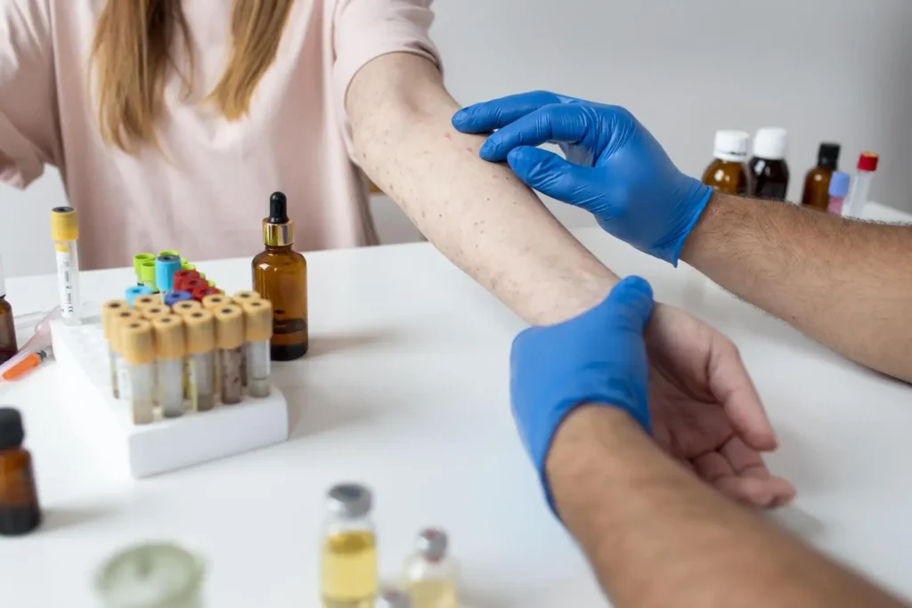 Maestría en Dermatitis Atópica y de Contacto y su Impacto Estético 1