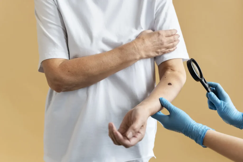 Maestría en Diagnóstico Dermatológico y Triaje de Lesiones Cutáneas 1
