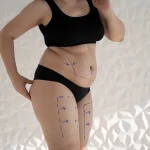 Maestría en Cirugía de Contorno Corporal Liposucción Lipo HD y Lipoescultura 1
