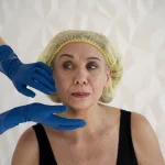 Maestría en Rejuvenecimiento Facial Quirúrgico Lifting Facial y Cuello 1