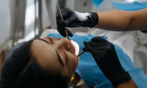 Curso en Prevención de Caries y Fluoración